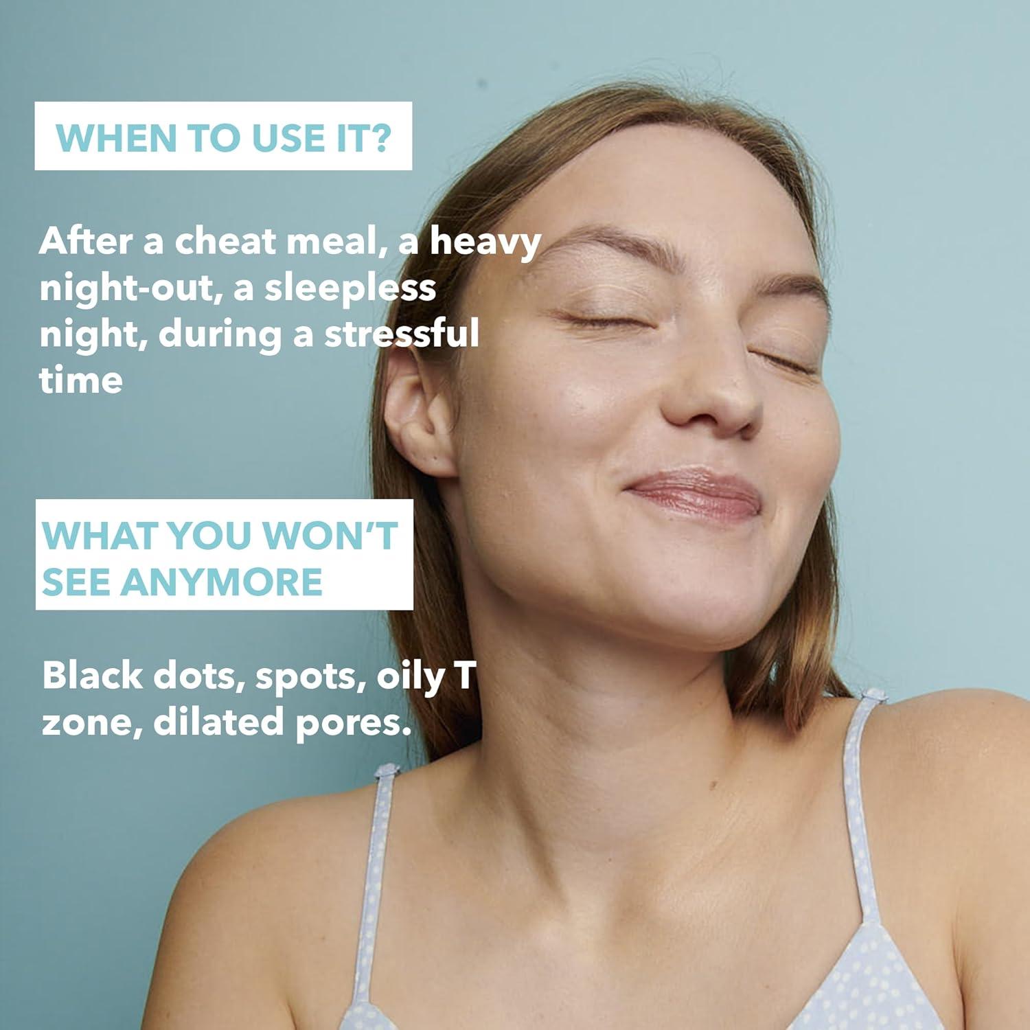 Mascarilla Facial RARE Paris Carbone Glacé - 5 Unidades