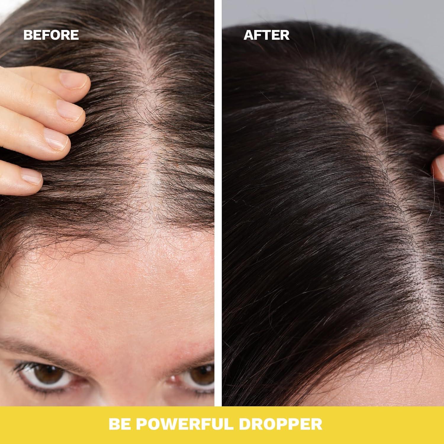 Suero Vegano para Crecimiento del Cabello GINGERMILK 59 ml