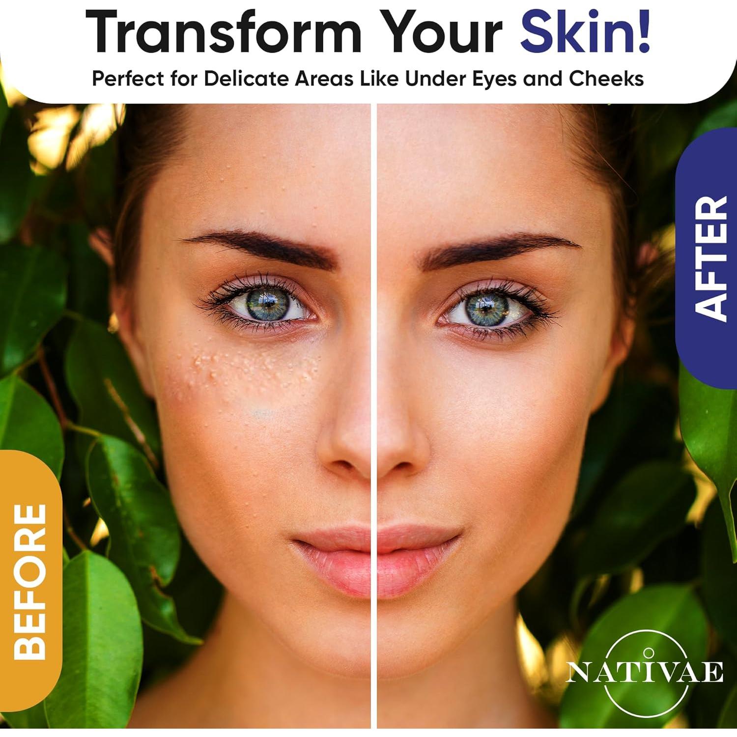 Suero para Milia Nativae con Ácido Salicílico y Té - 81g