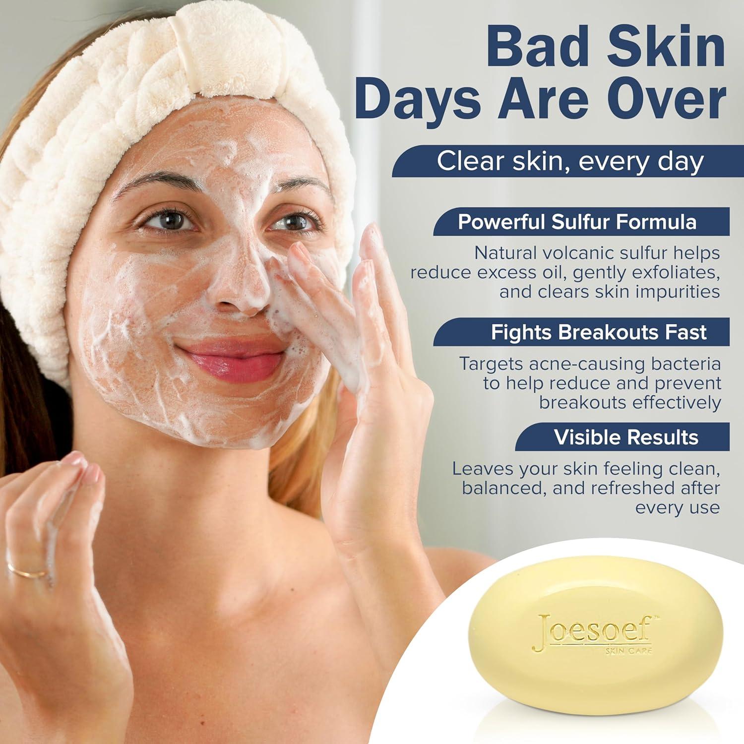 Jabón de Azufre Joesoef 100g - Cuidado de la Piel para Acné