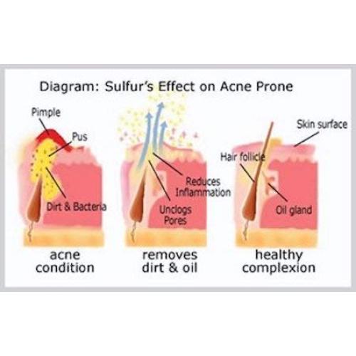 Jabón de Azufre Joesoef 100g - Cuidado de la Piel para Acné