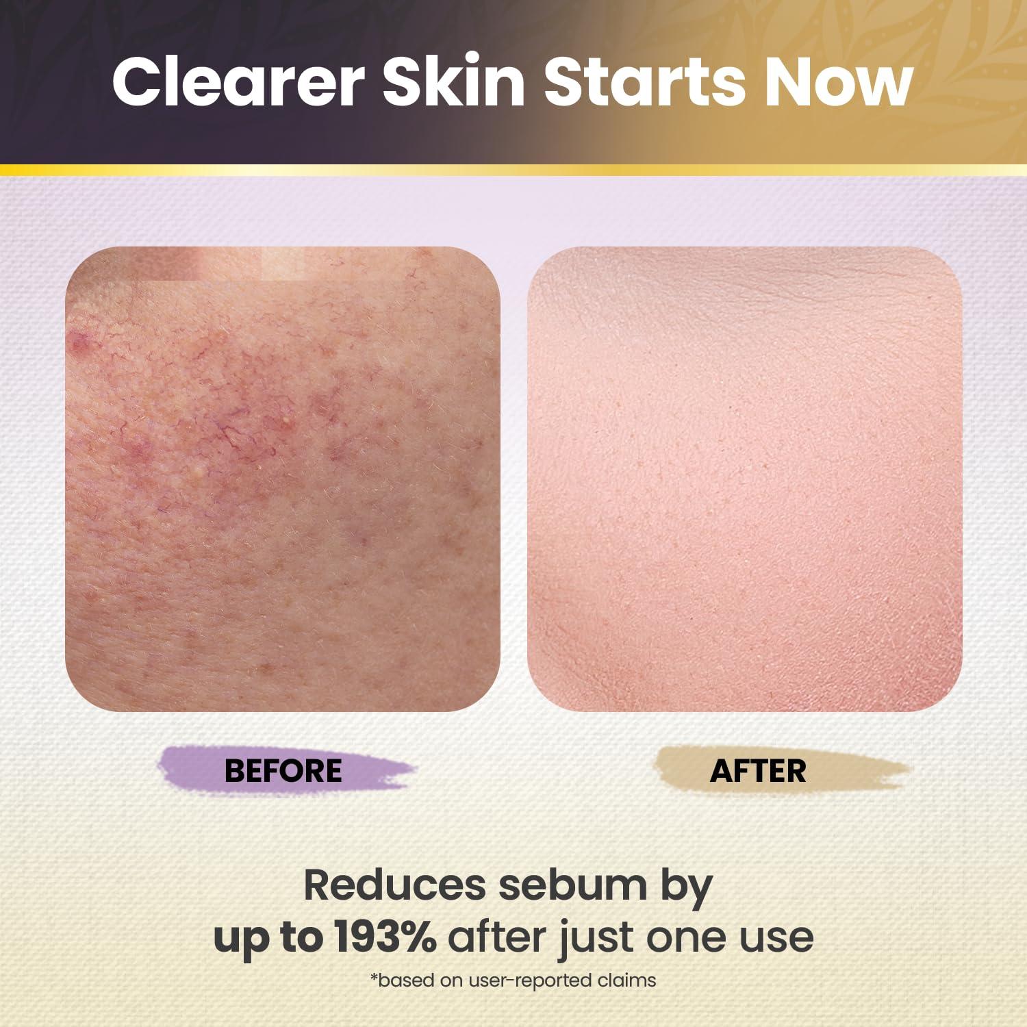 Duo de Peel Shot Okaga Arroz Negro y Blanco 330g Cuidado Piel