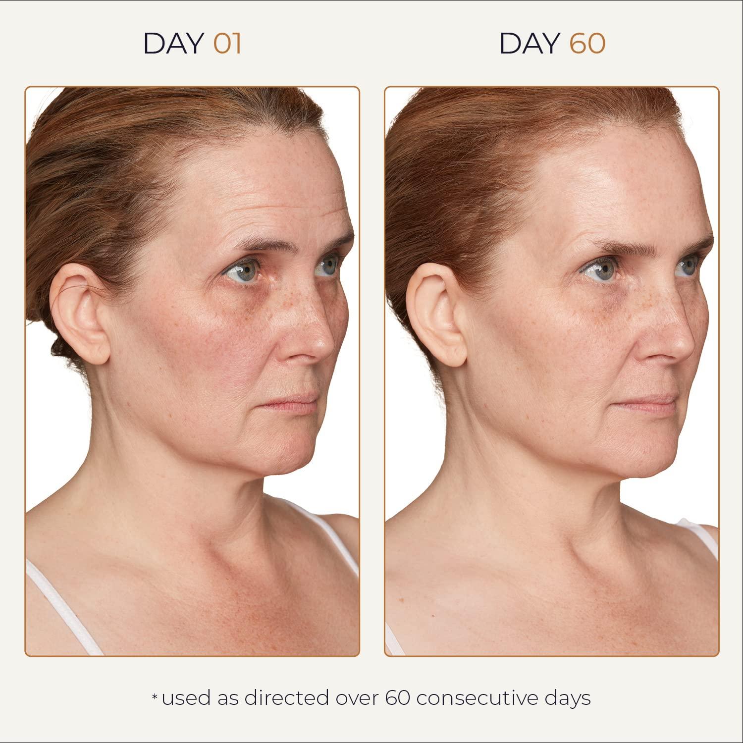 Suero Eliminador de Manchas Oscuras Tru Alchemy 30 ml