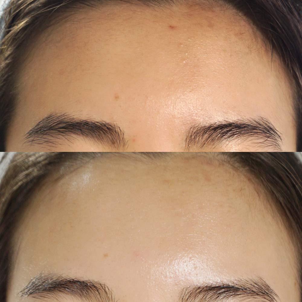 Crema Reparadora Bonajour para Acné 51.24 ml - Cuidado Intensivo