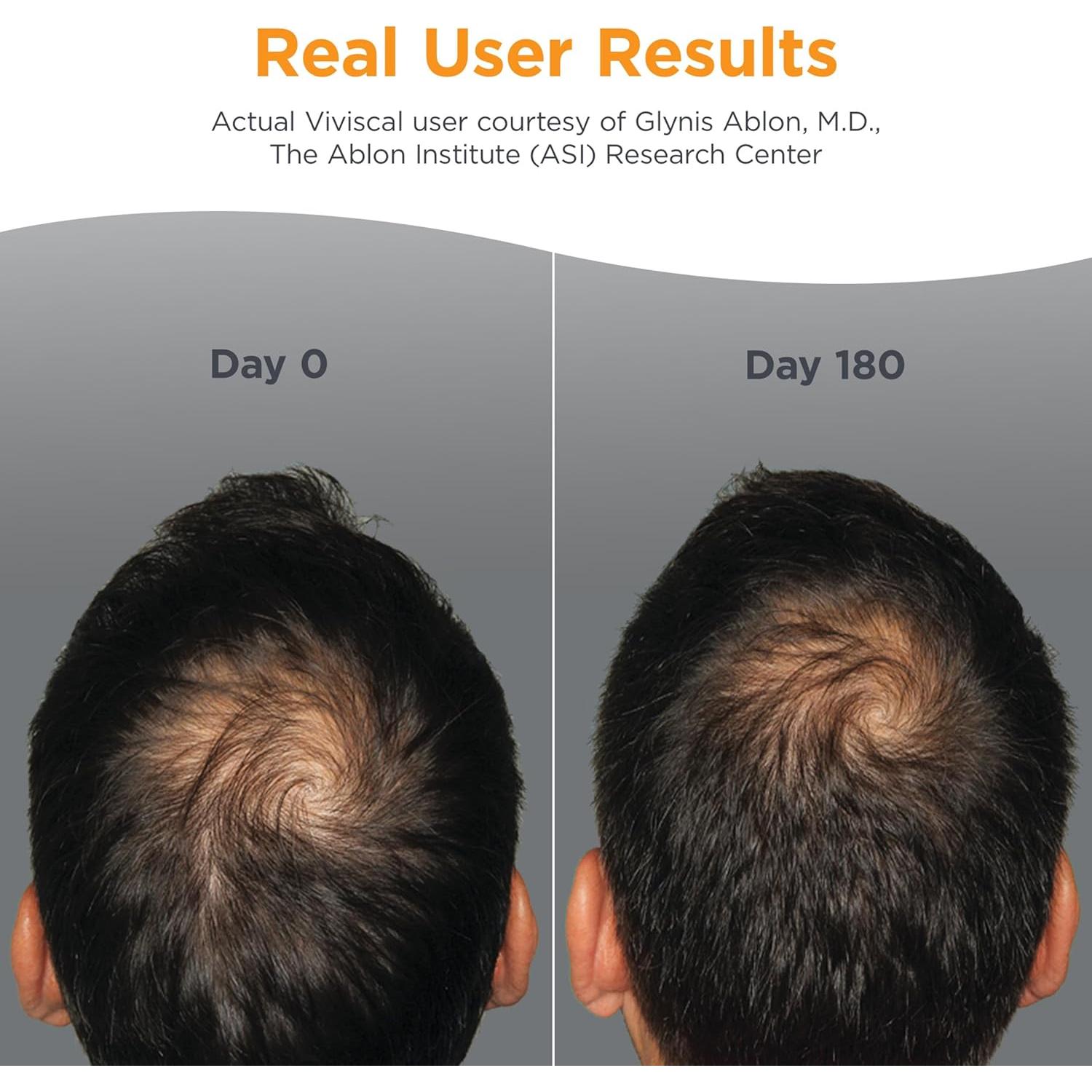 Suplemento Crecimiento Cabello Viviscal Hombre 180 Tabletas