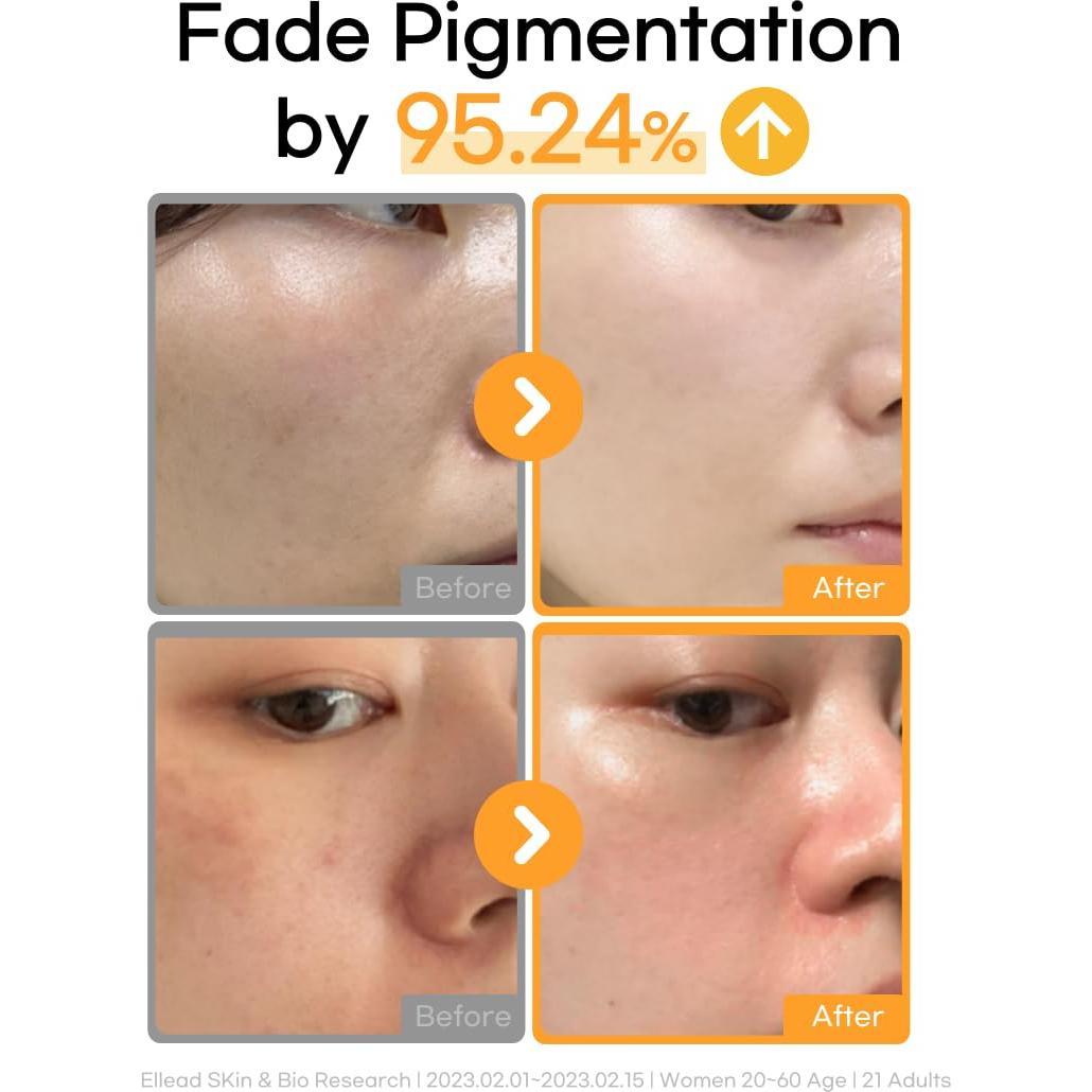 Suero Facial Daymellow Vita Ferol 23% Vitamina C 20ml