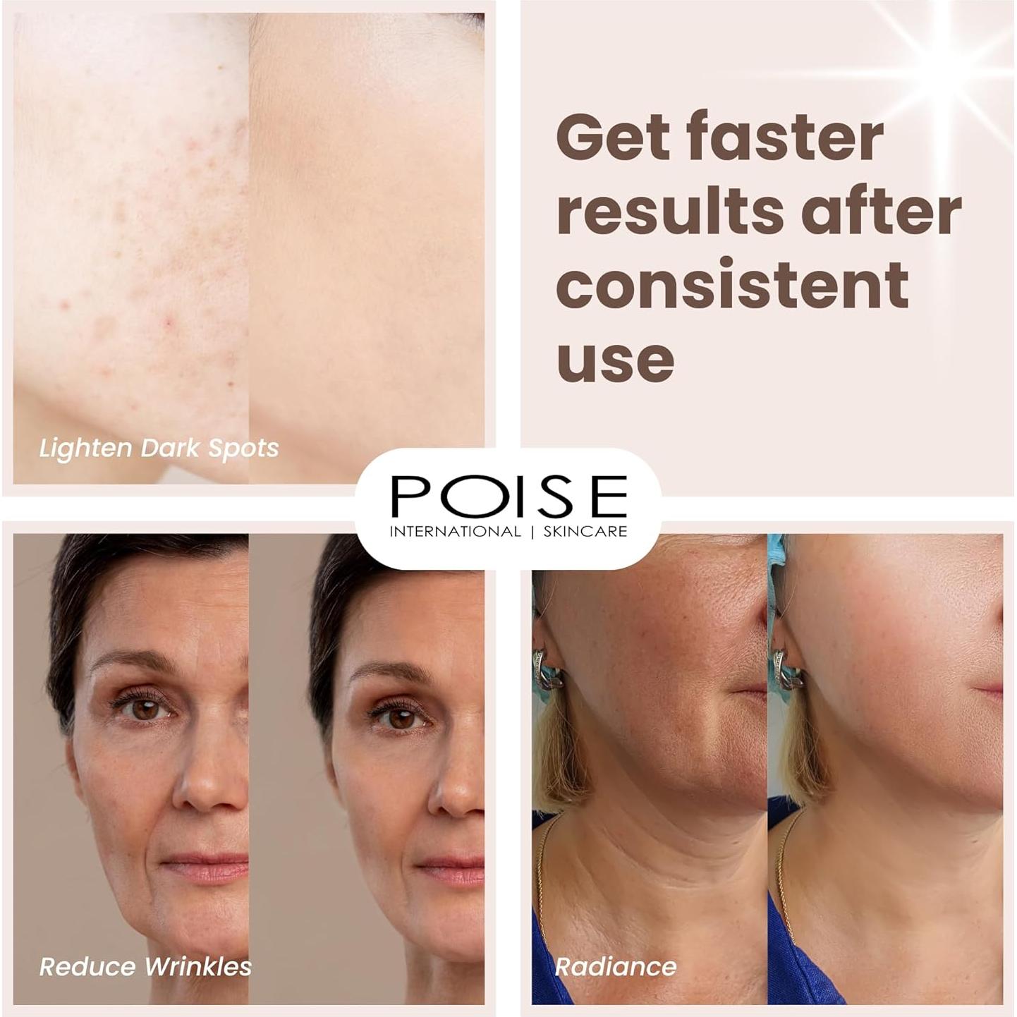 Suero Facial POISE Cuidado de la Piel 30ml Vitamina C E A