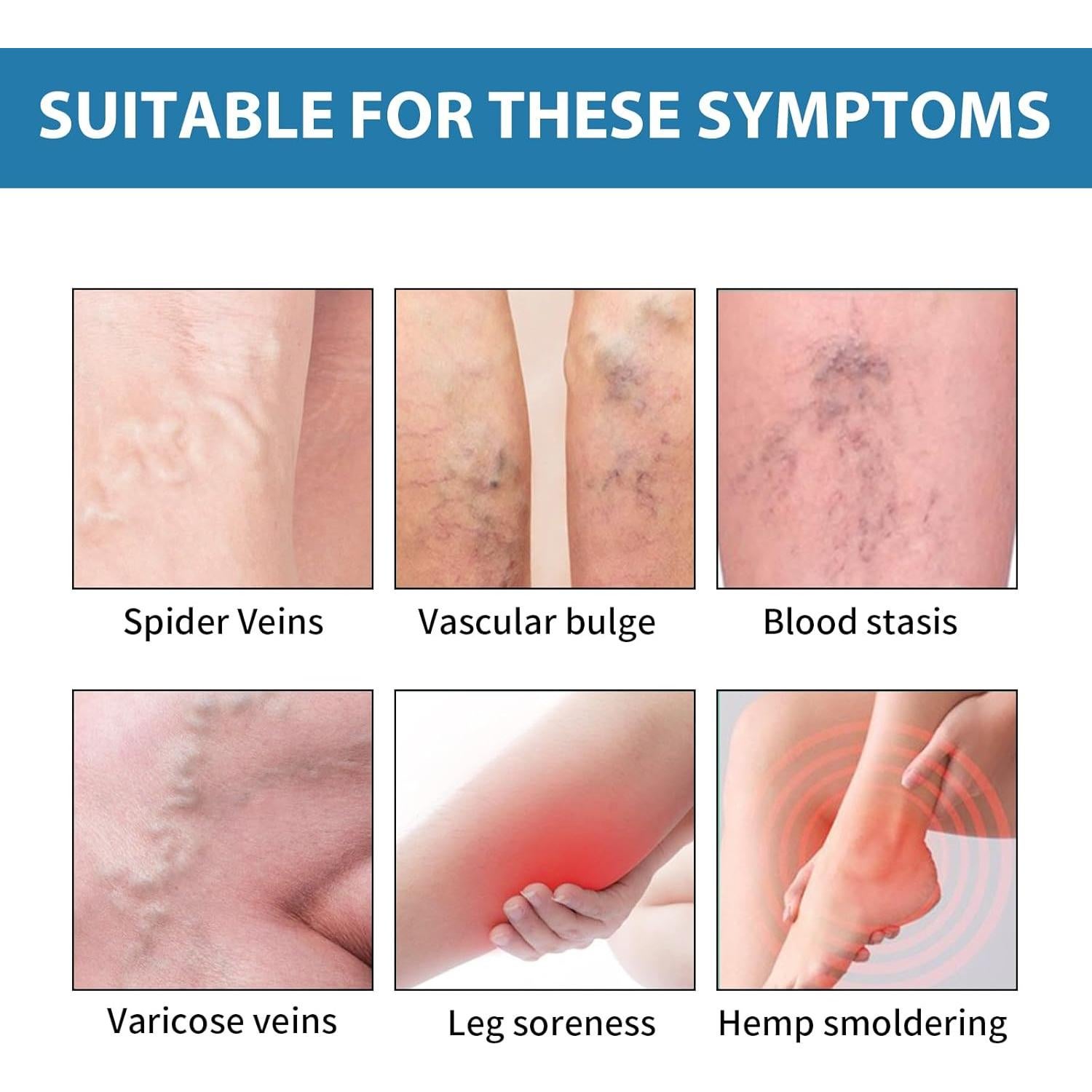 Crema Calmante para Venas Varicosas SUGOYO 39.4 g Alivio Natural