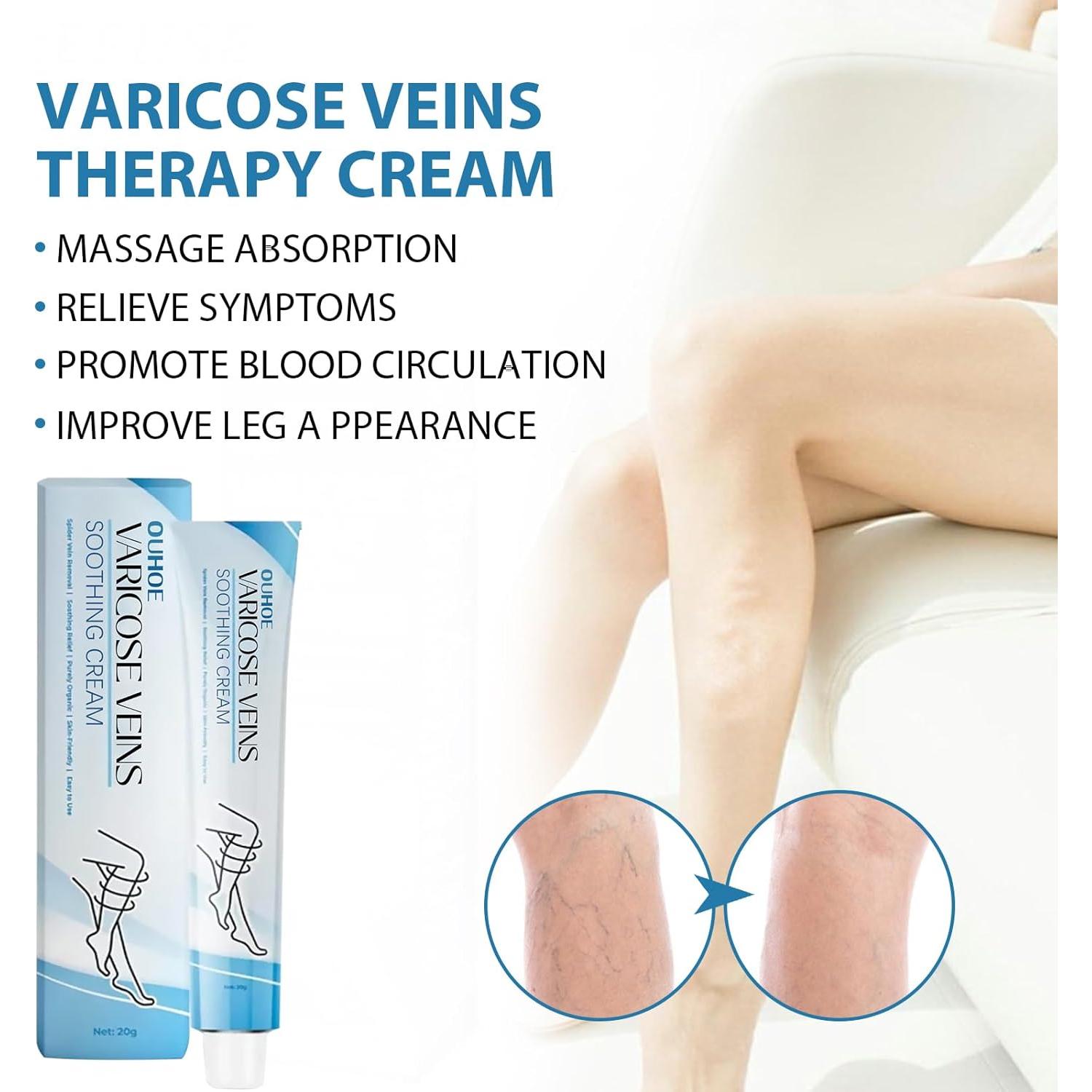 Crema Calmante para Venas Varicosas SUGOYO 39.4 g Alivio Natural