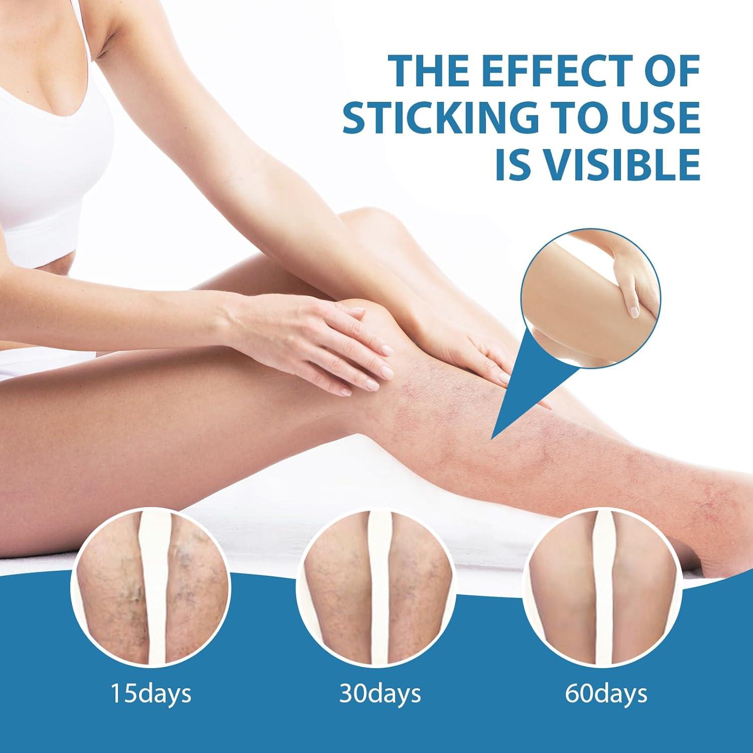 Crema Calmante para Venas Varicosas SUGOYO 39.4 g Alivio Natural