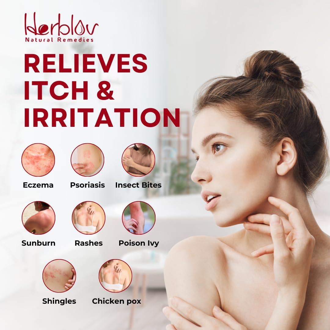 Jabón de Calamina Herblov 115g - Alivio Natural para Picazón