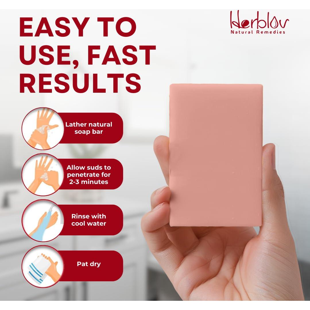 Jabón de Calamina Herblov 115g - Alivio Natural para Picazón