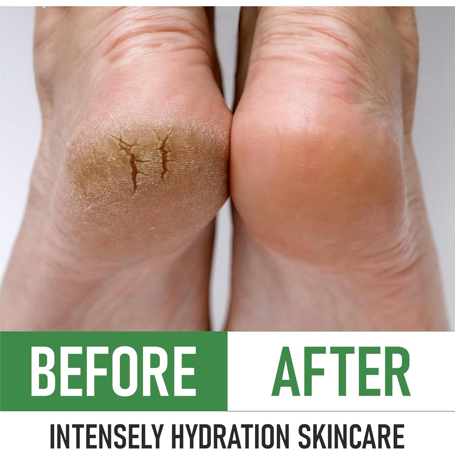 Crema para Pies 40% Urea PurOrganica - Reparación Intensiva