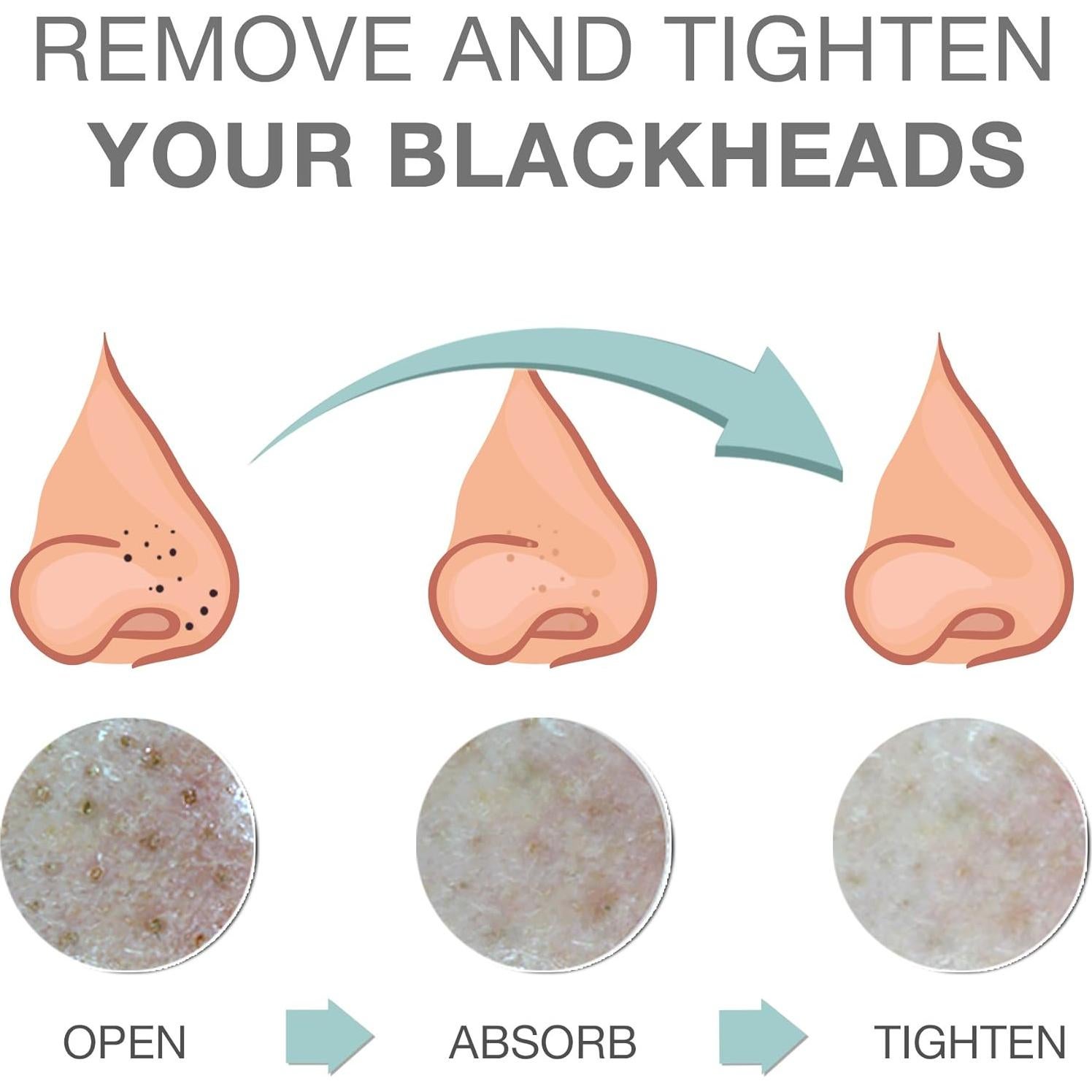 Gel Calentador de Poros BRTC 35g | Exfoliación y Limpieza Profunda