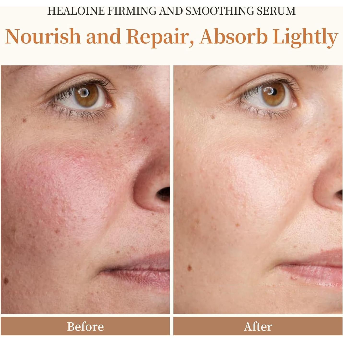 Suero Facial Hidratante HEALOINE con Niacinamida y Ácido Hialurónico