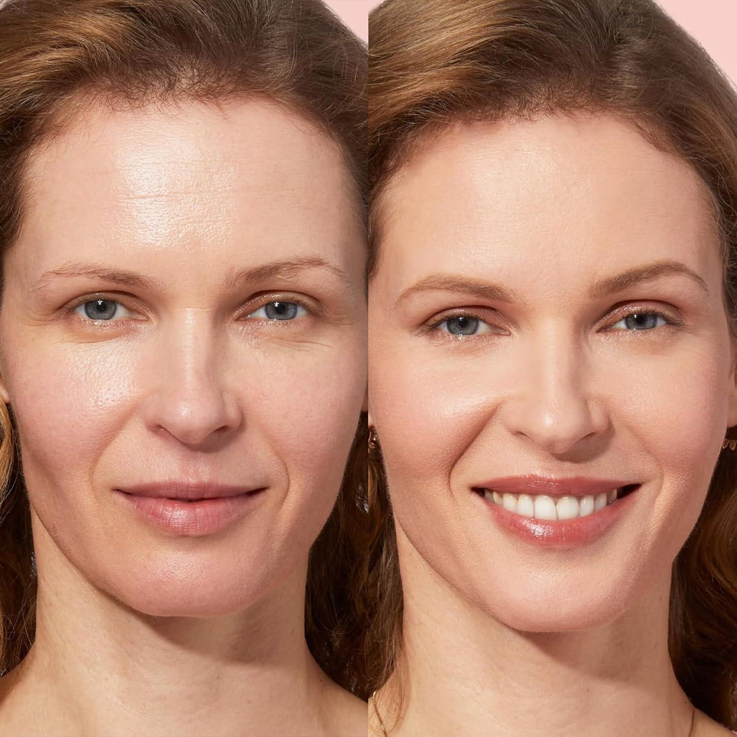 Suero Facial Hidratante HEALOINE con Niacinamida y Ácido Hialurónico