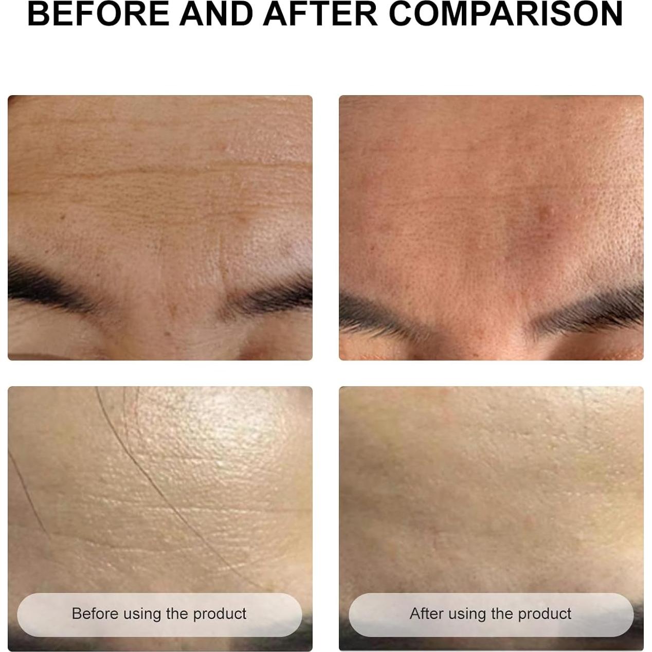 Parches Antienvejecimiento para Arrugas en la Frente - Secret Strips - 10 Pares