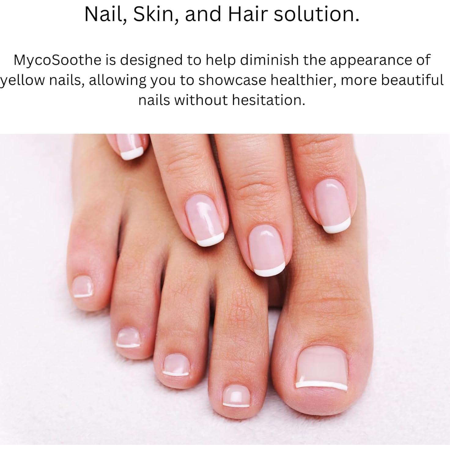 Suplemento Antioxidante MycoSoothe - 60 Cápsulas para Uñas y Inmunidad