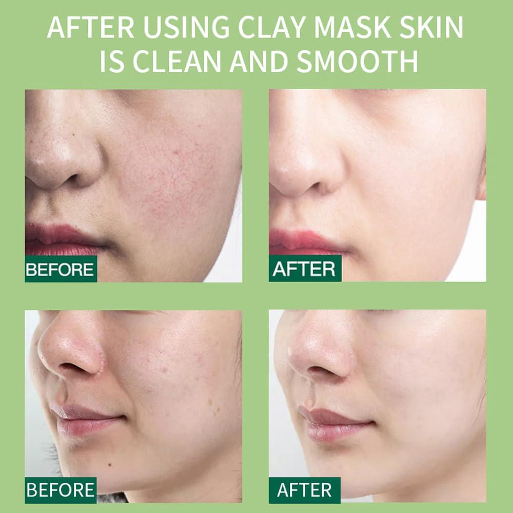 Set de 10 Mascarillas de Arcilla LFuTPm - Hidratantes y Exfoliantes