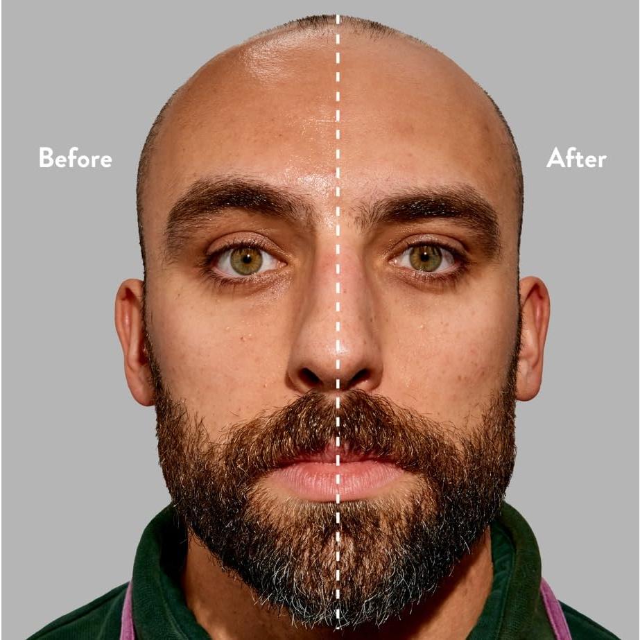 Harry's Anti-Brillo Stick para Piel Grasa - 2 Paquete - 9.9 g