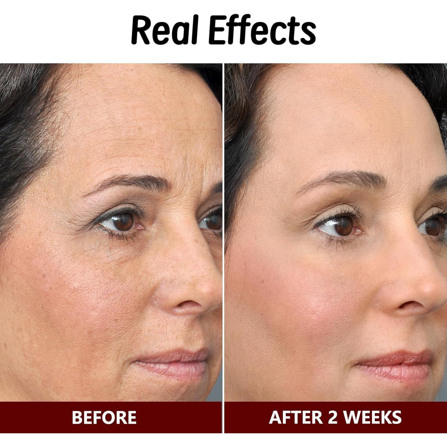 Crema Integral de Veneno de Abeja Virularty 2 Botellas 159g