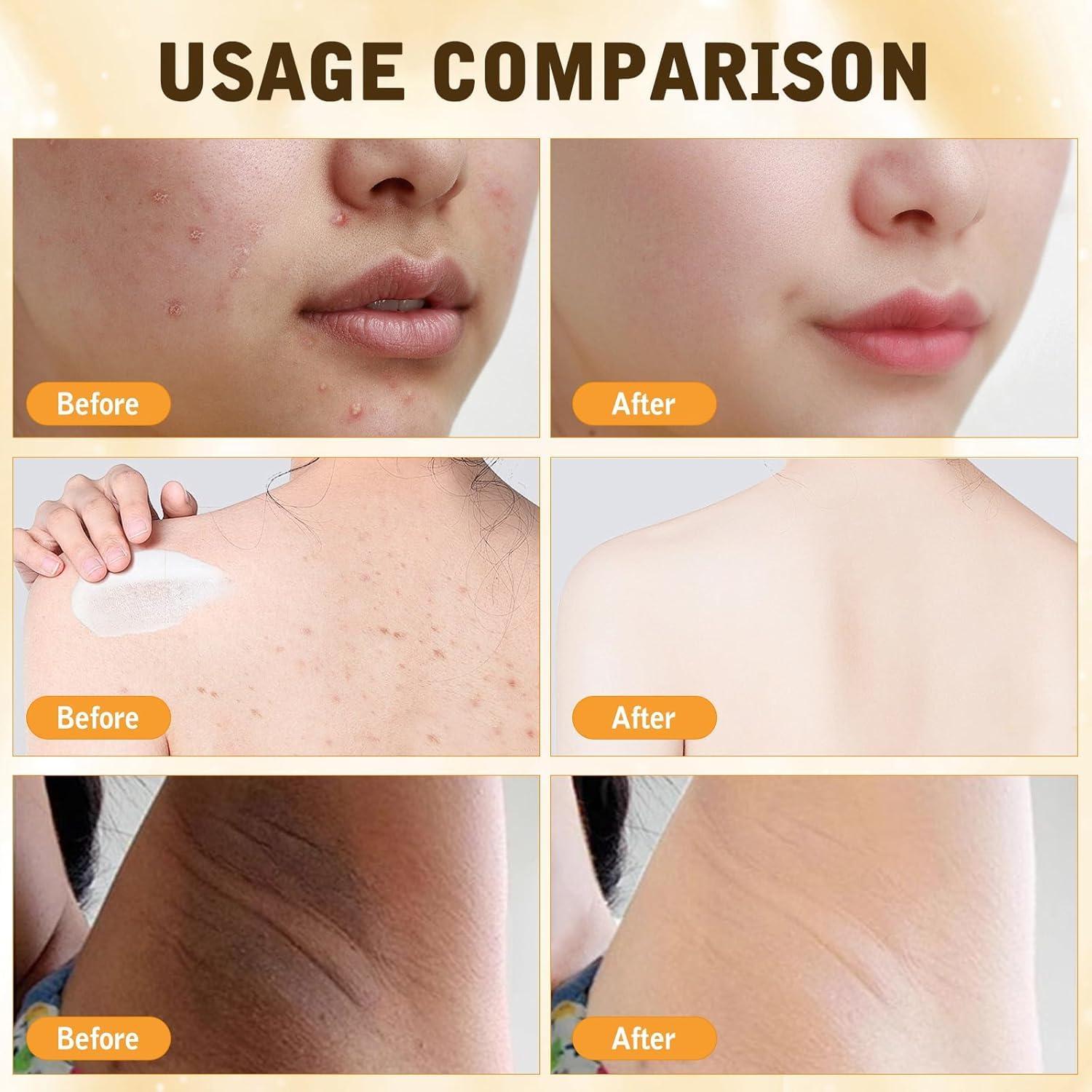 Crema Integral de Veneno de Abeja Virularty 2 Botellas 159g