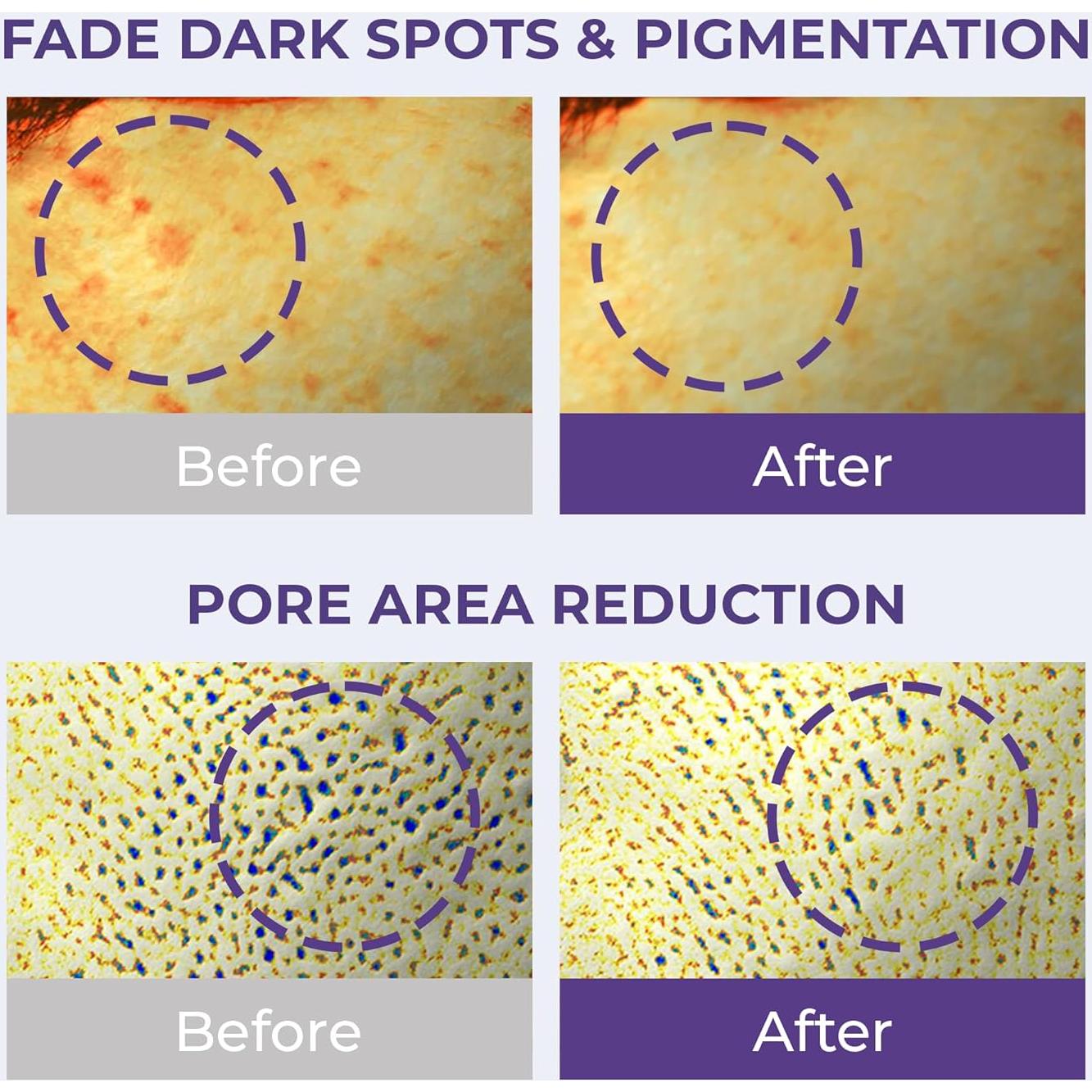 Ampolla Iluminadora RAWQUEST Cardo Lechero 132g Piel Seca