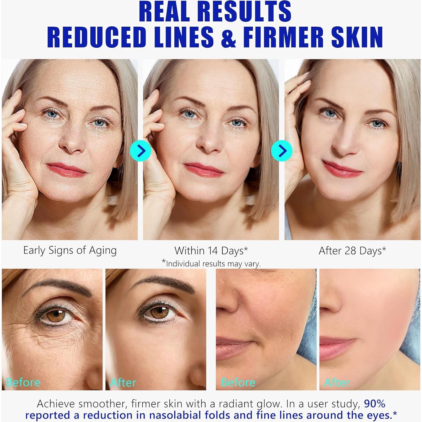 Suero Antienvejecimiento ZODENIS 35.4 ml Células Madre Hidratante