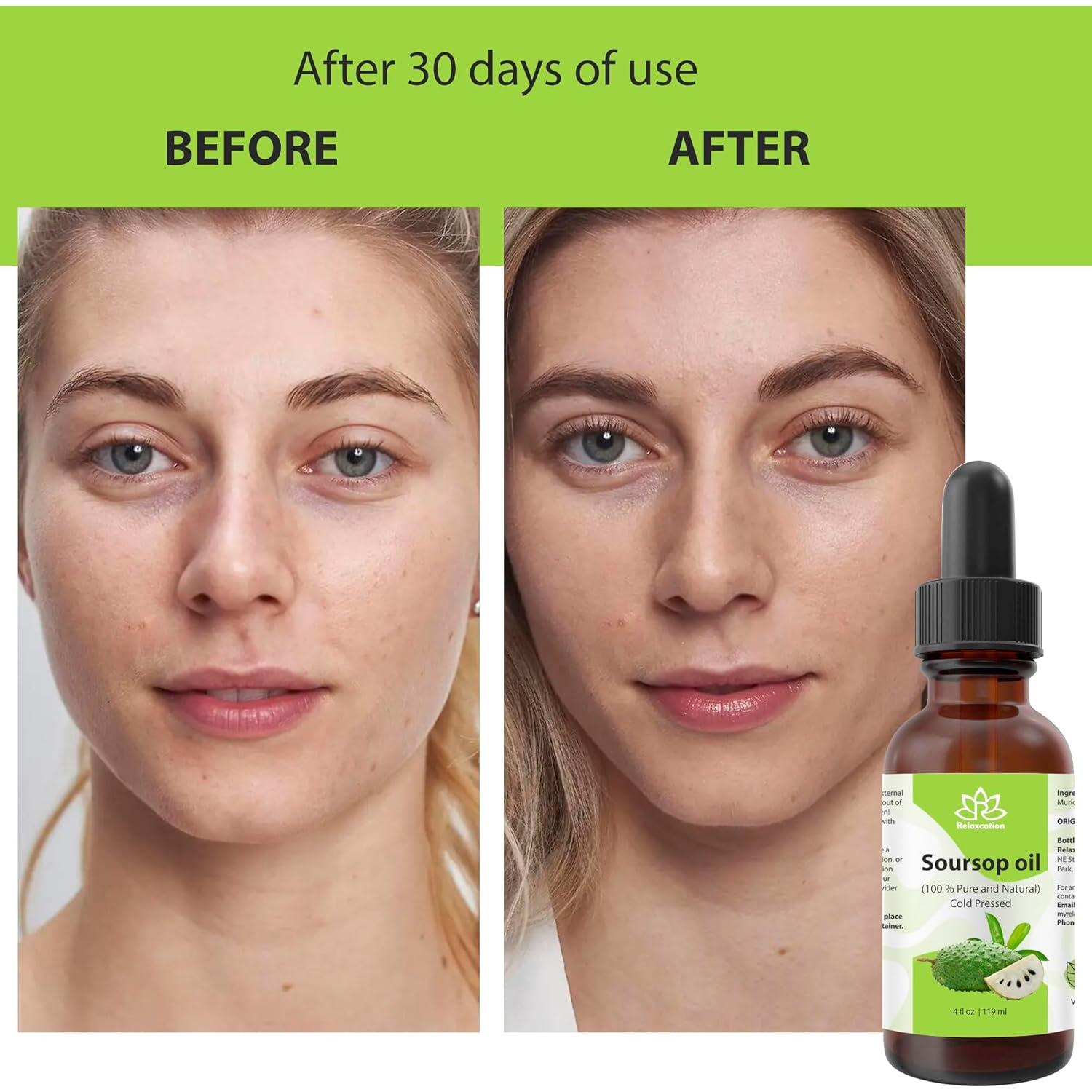 Aceite de Graviola Relaxcation 59 ml - Puro y Virgen para Piel