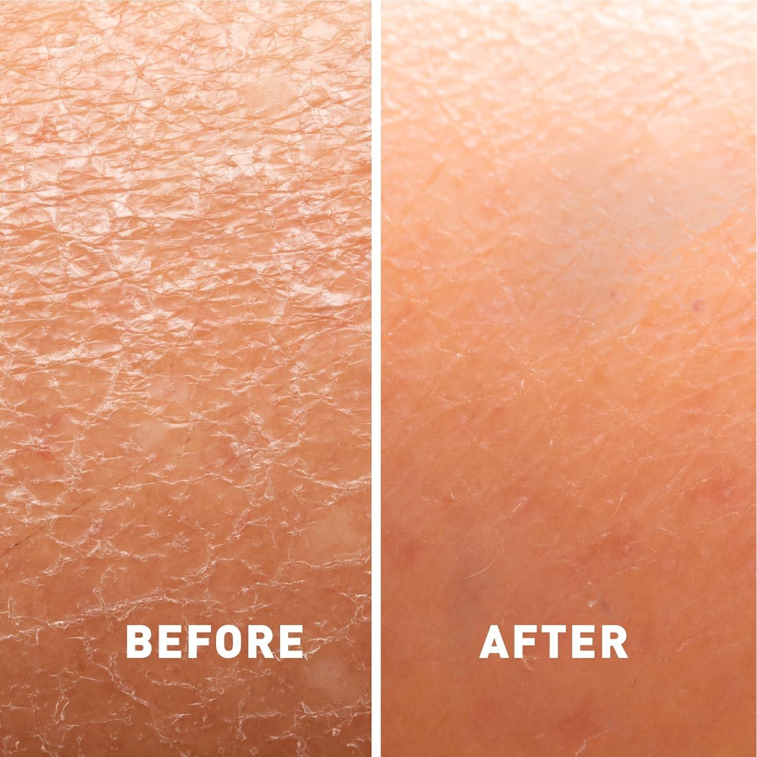 Loción Calmante Just Nutritive 453 g para Piel Seca y Eccema