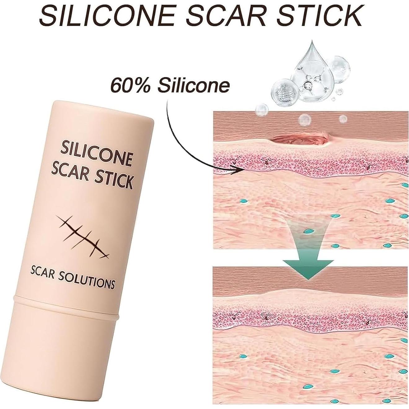 Barra de Silicona para Cicatrices Prequel Skin 60% 140g