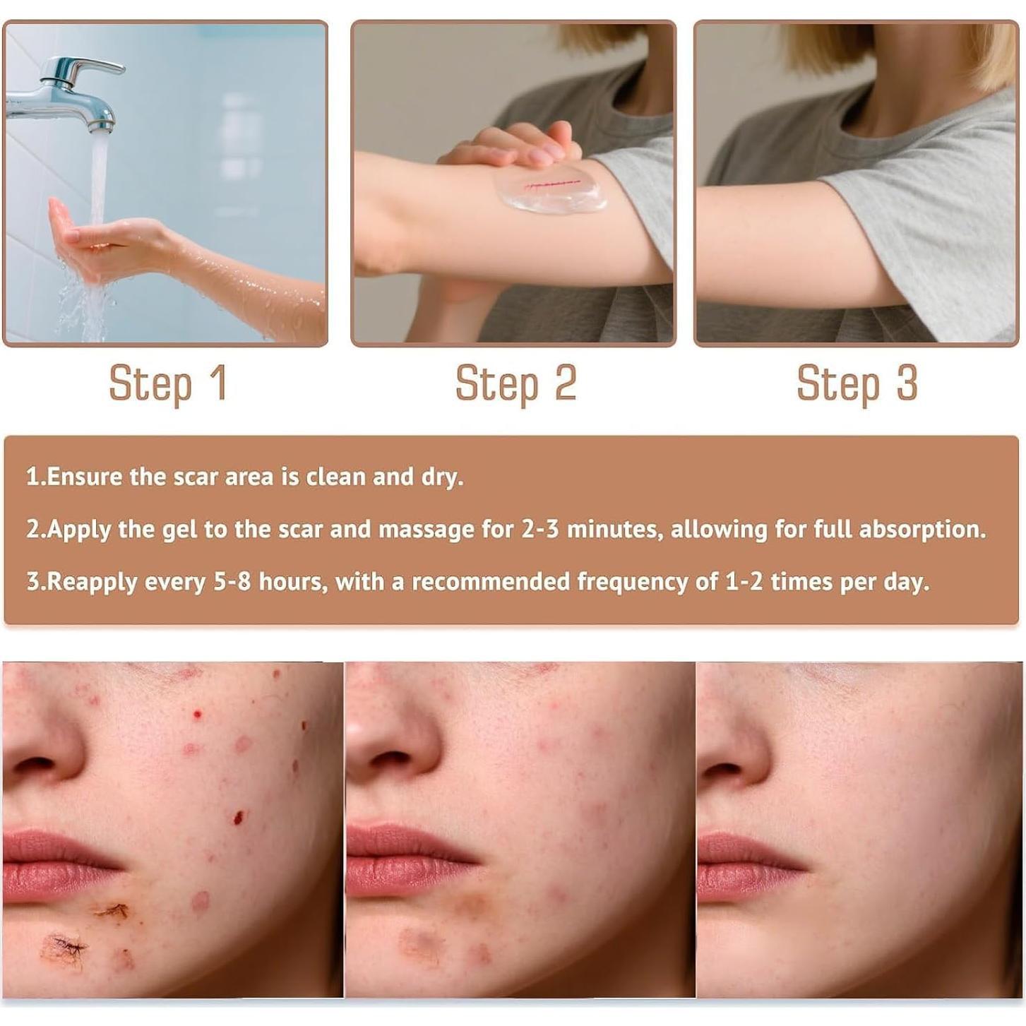 Barra de Silicona para Cicatrices Prequel Skin 60% 140g