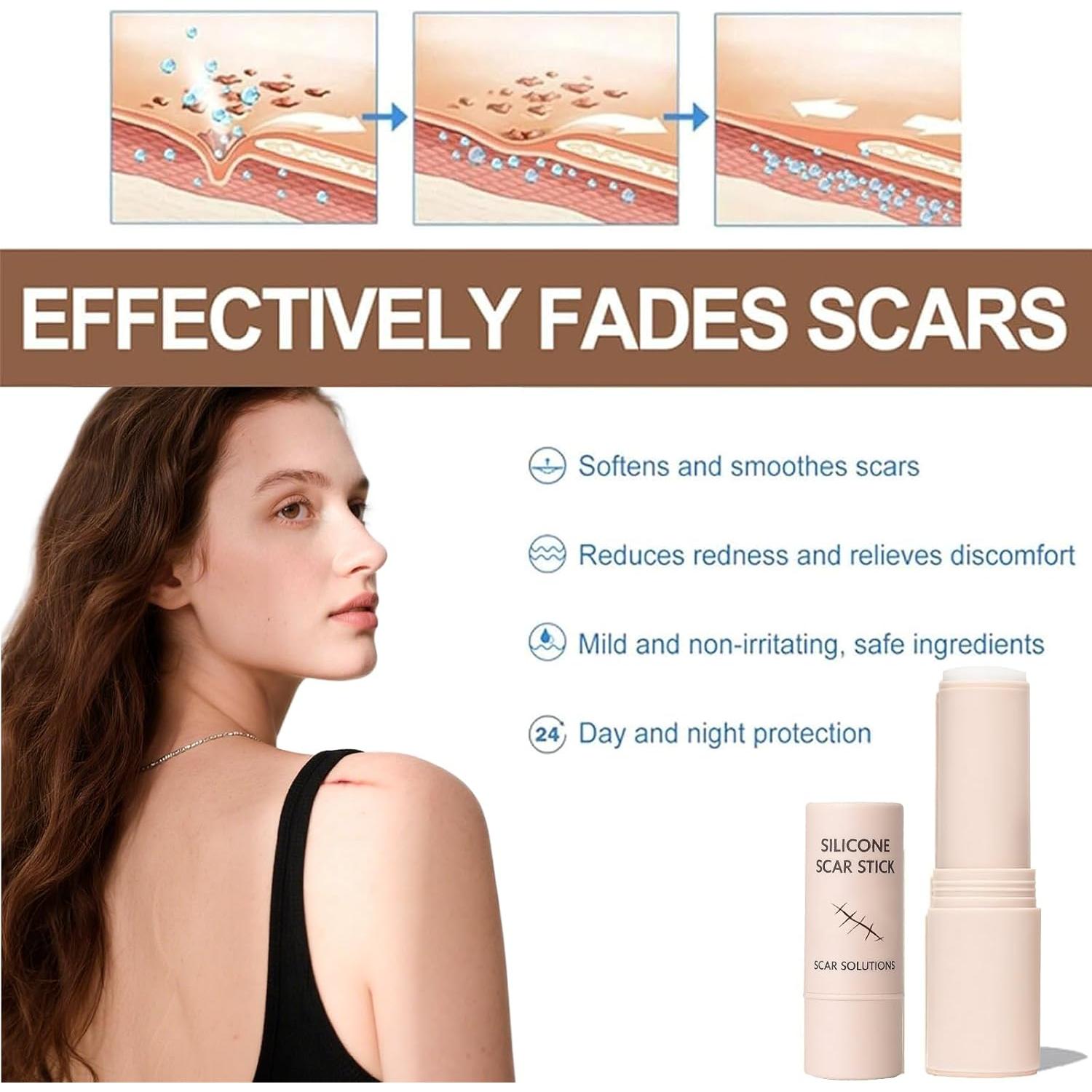 Barra de Silicona para Cicatrices Prequel Skin 60% 140g