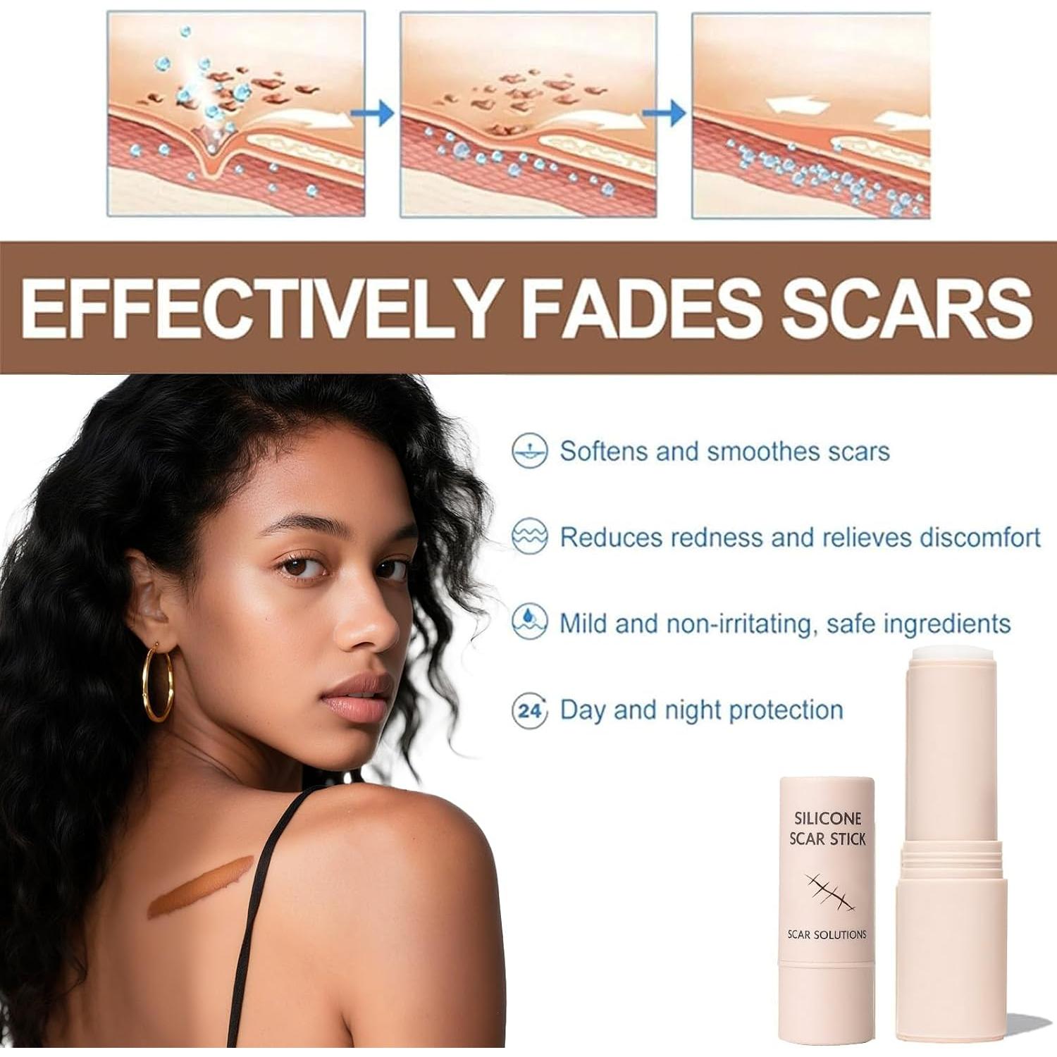 Barra de Silicona para Cicatrices Prequel Skin 60% 140g