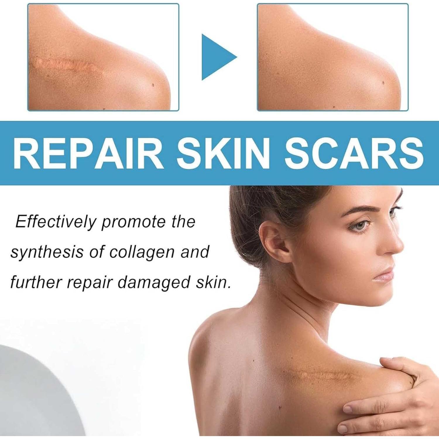 Stick de Silicona para Cicatrices RIWYDMA 60% 20g