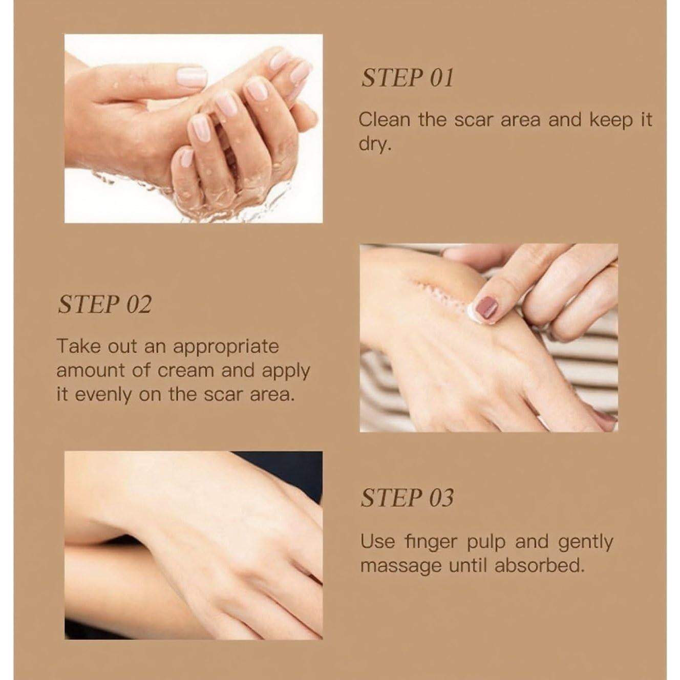 Bastón de Silicona para Cicatrices SACDSSA - 60% Silicona, 2PCS