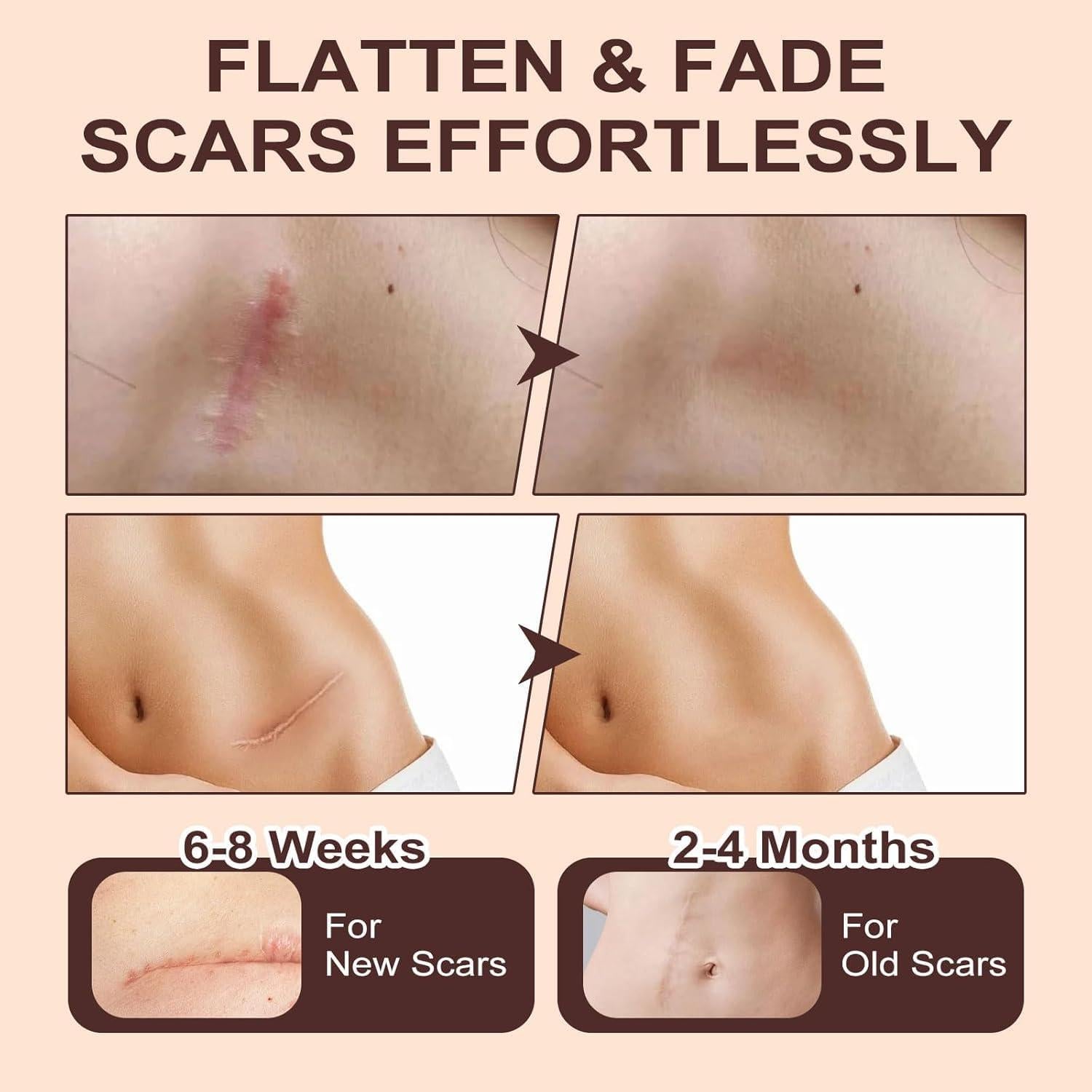 Bastón de Silicona para Cicatrices SACDSSA - 60% Silicona, 2PCS