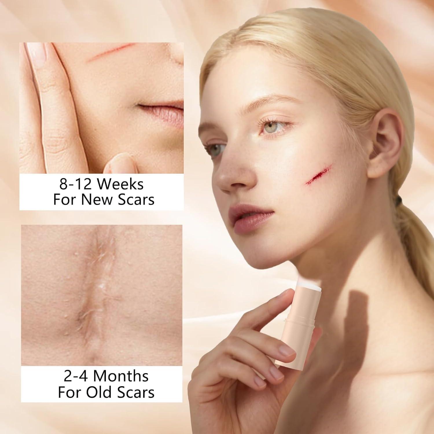 Bastón de Silicona para Cicatrices Scar Solutions - 60% Silicona