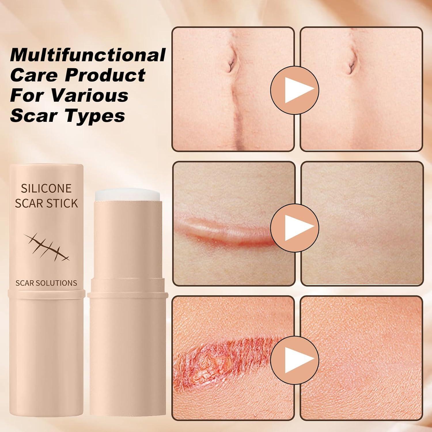 Bastón de Silicona para Cicatrices Scar Solutions - 60% Silicona