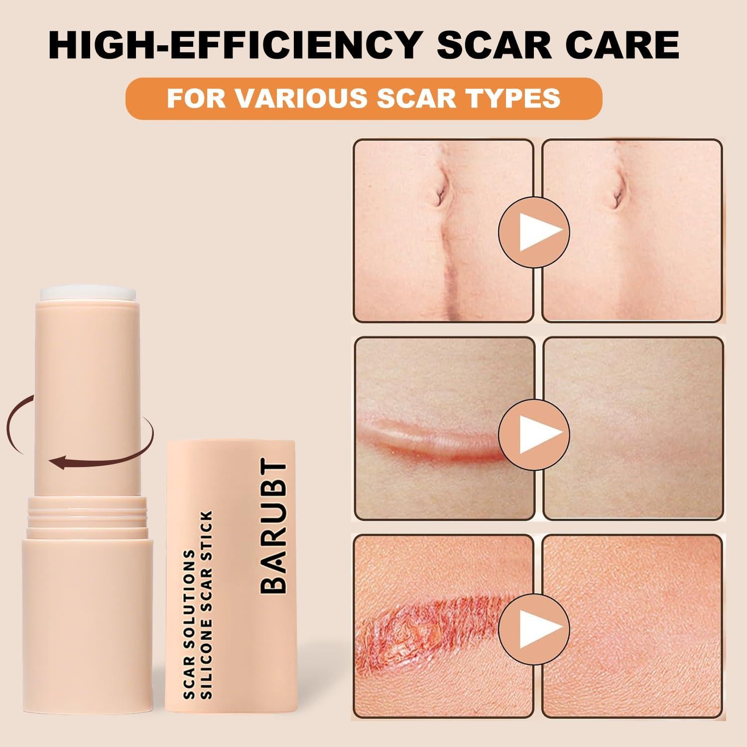 Barra de Silicona 10g OLELON 60% para Cicatrices con Centella