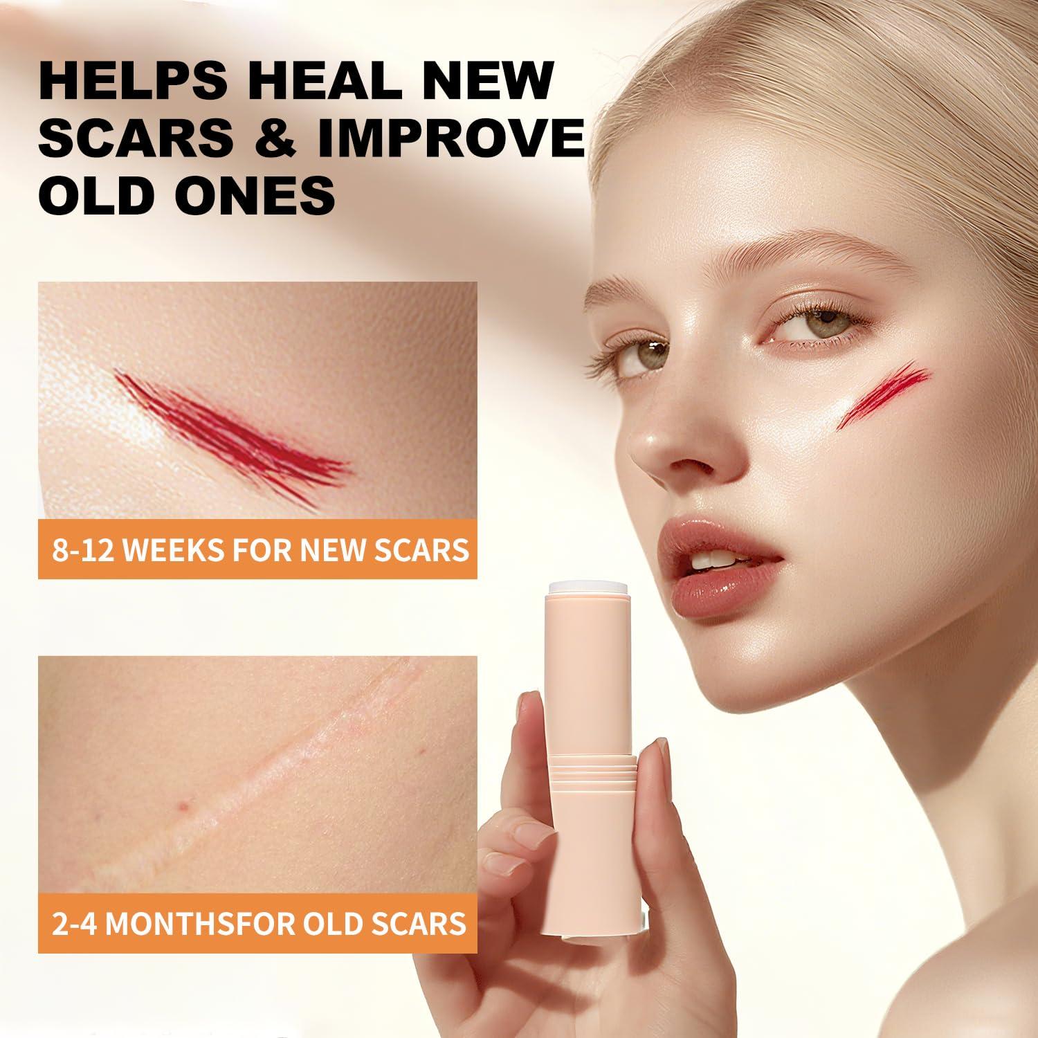 Barra de Silicona 10g OLELON 60% para Cicatrices con Centella