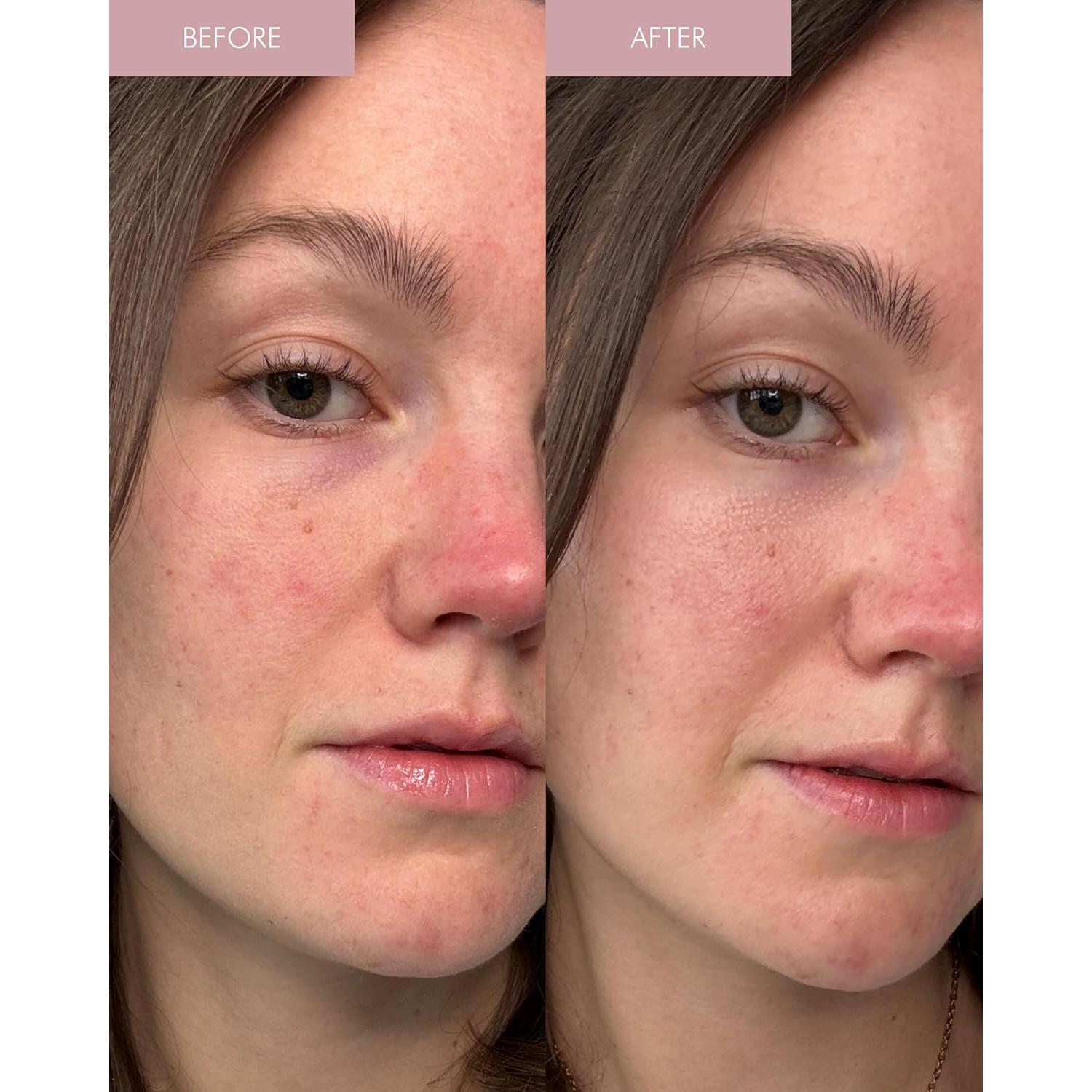 Suero Hidratante MARA 3-en-1 con Péptidos de Perla 100 ml