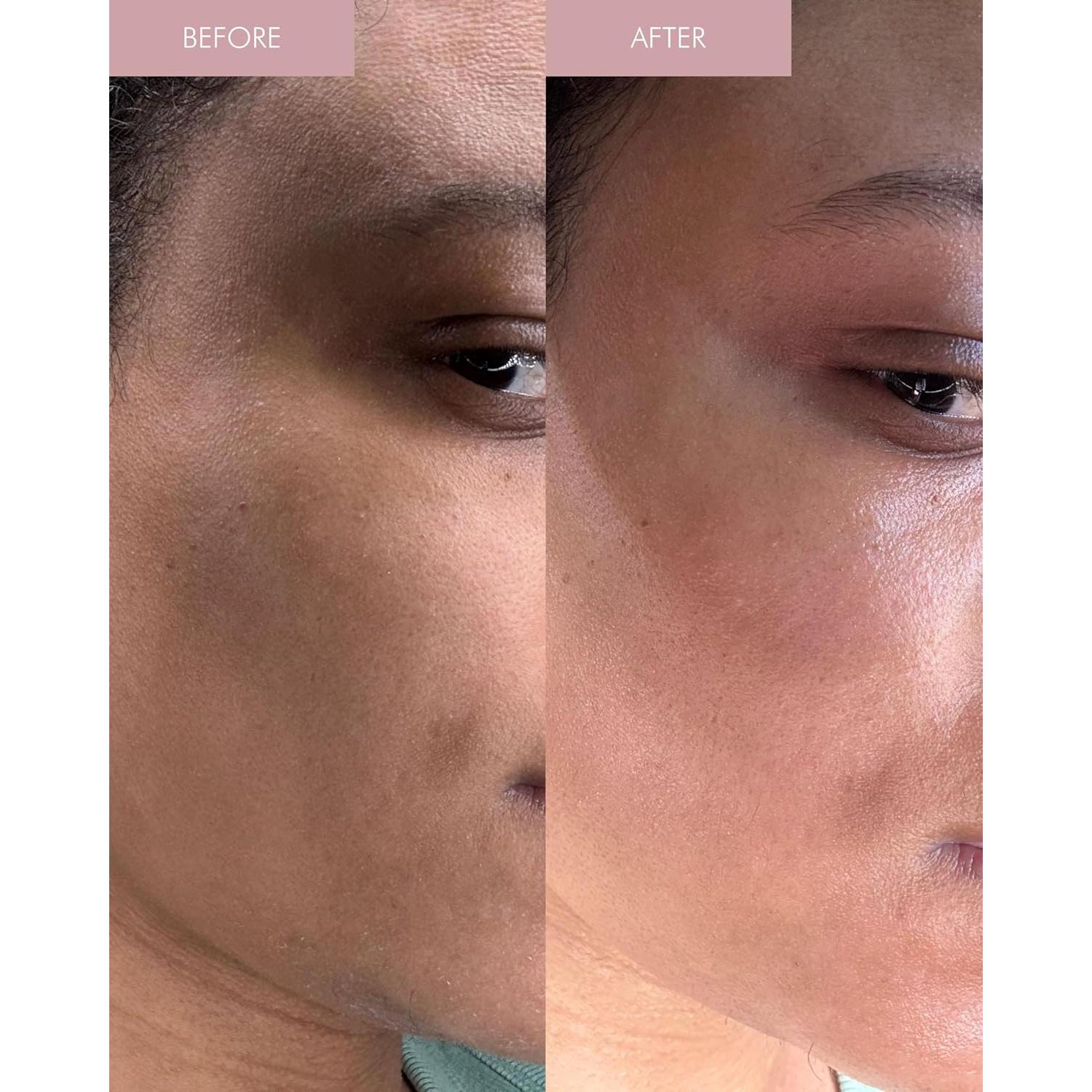 Suero Hidratante MARA 3-en-1 con Péptidos de Perla 100 ml