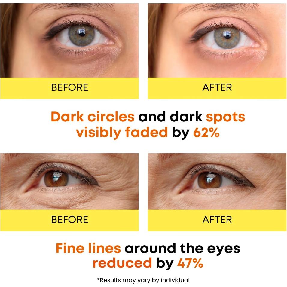 Mascarillas para Ojos Eco Glow con Vitamina C - 50 Parches Hidratantes