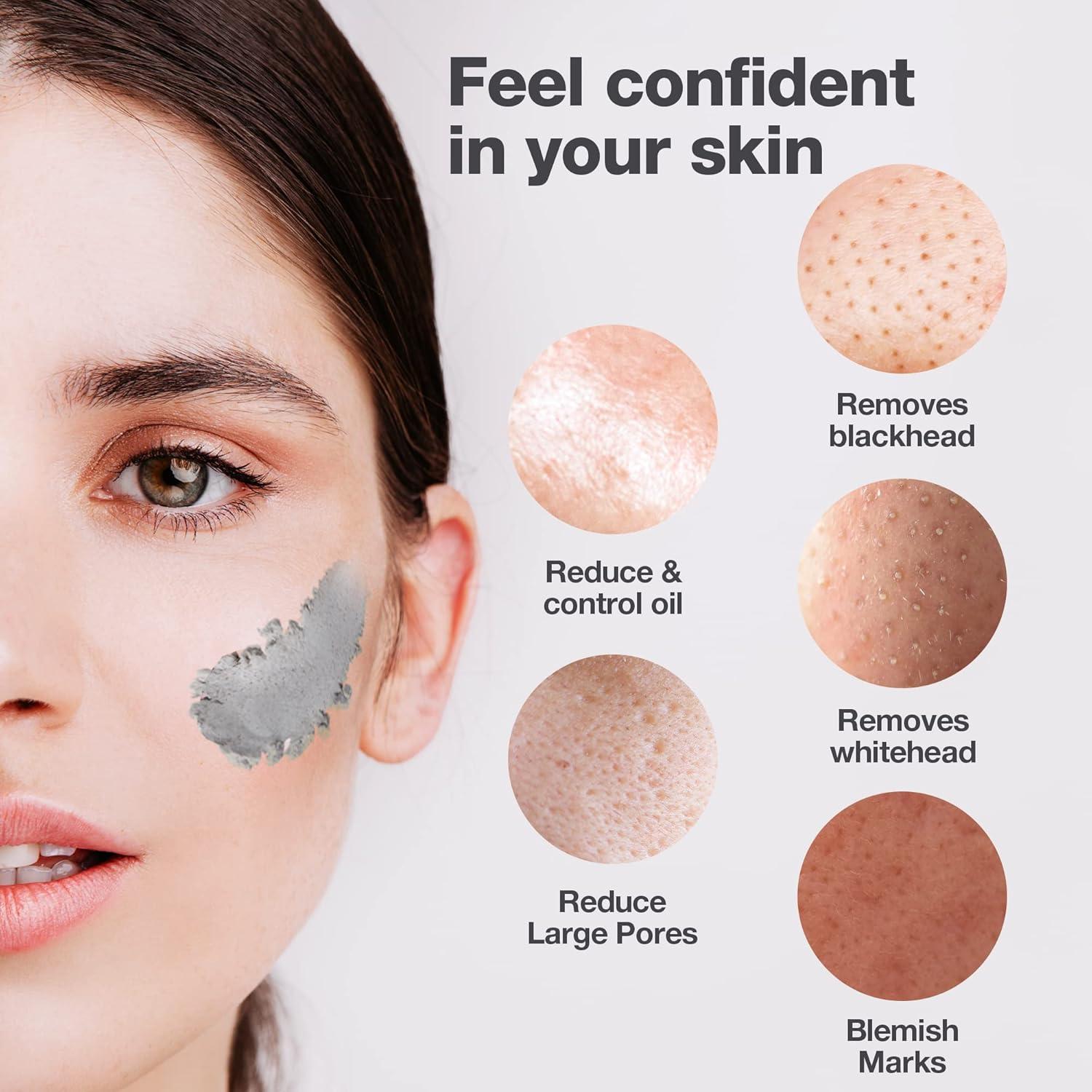 Stick Removedor de Puntos Negros Deeom - 14g, Exfoliante Natural