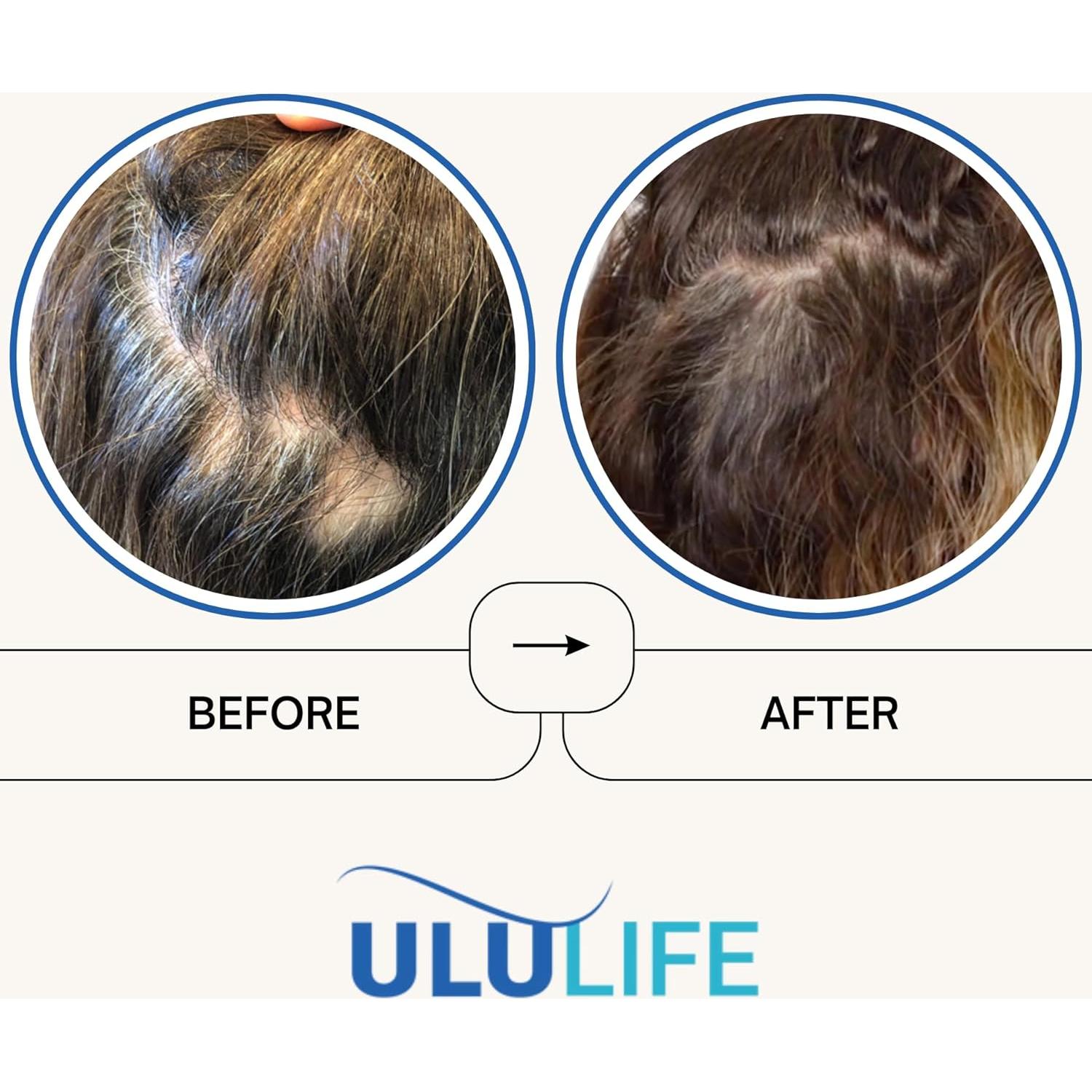 Multivitamina ULU Regrow Definitiva 540 Cápsulas - Crecimiento Cabello, Piel y Uñas