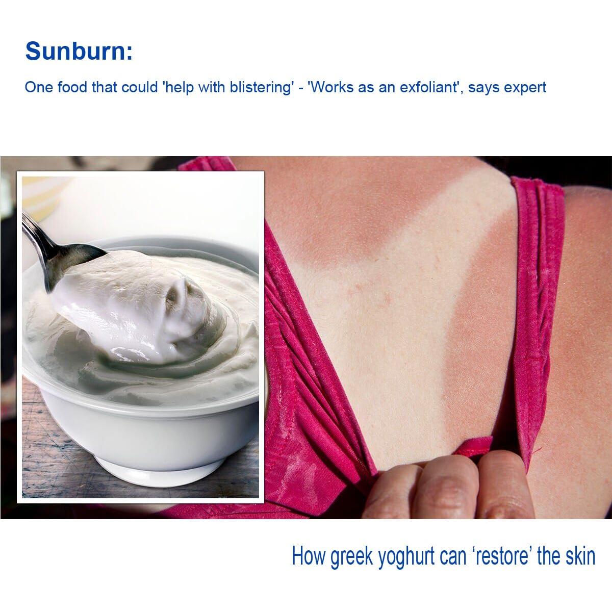 Paquete Alivio Quemaduras Solares Aloe First 500 mL + Gel 20 mL