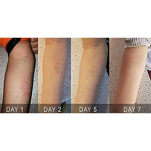 Crema Natural para Eczema Orellis con Caléndula y Propóleos