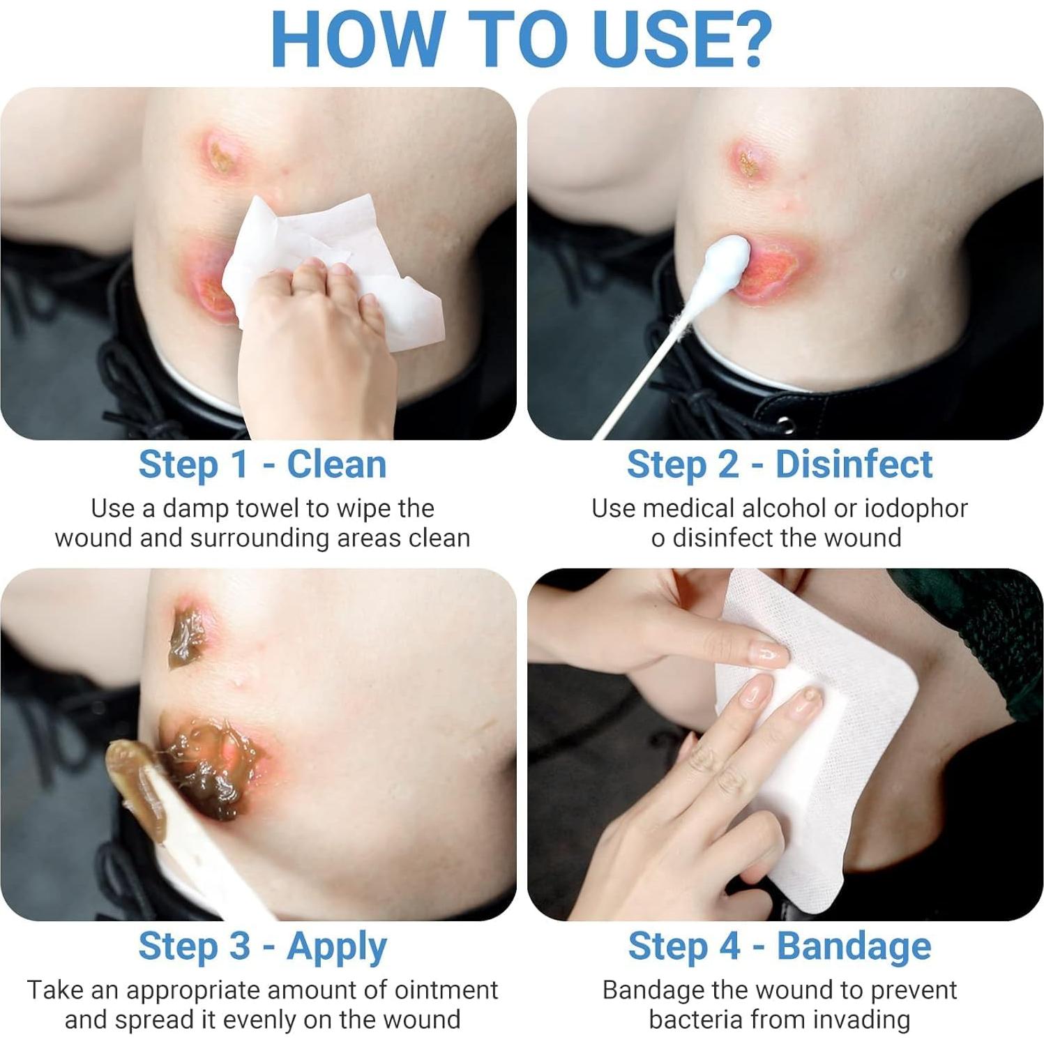 Ungüento Curativo LMNOOP 50g - Heridas, Quemaduras y Úlceras