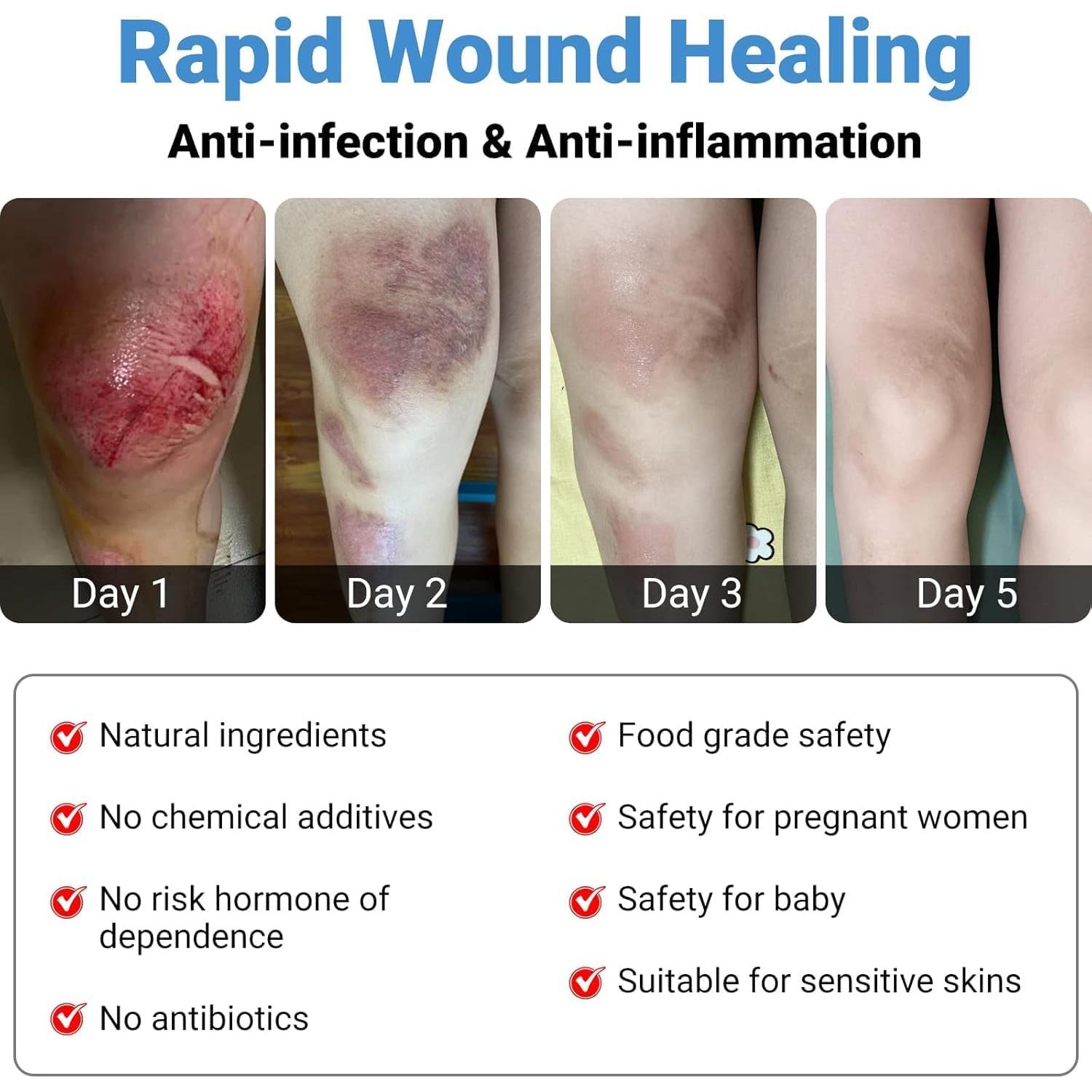 Ungüento Curativo LMNOOP 50g - Heridas, Quemaduras y Úlceras